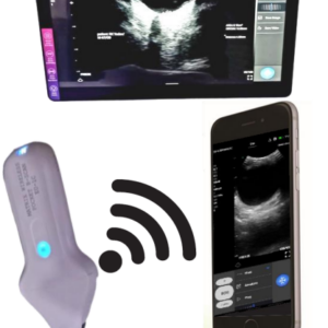 Matrix / Fujitron Digital Pocket Wireless B-Scan, Model EU-1C, (WO. Tab & Printer)